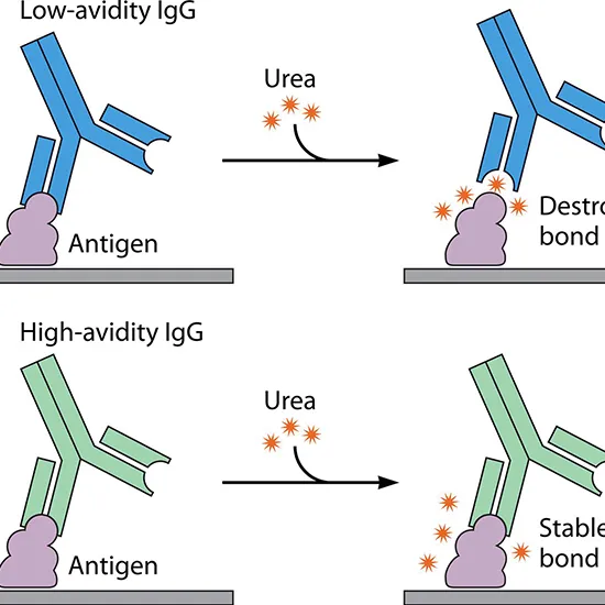 toxoplasma antibody igg test